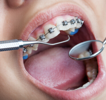 Ortodoncia y Ortopedia Dentomaxilar